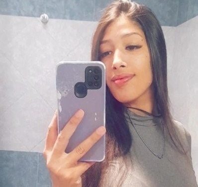 Ataque con ácido, estremecedor caso de una joven en Argentina