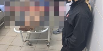 Hombre muere tras caer sobre una fogata en Yasy Cañy