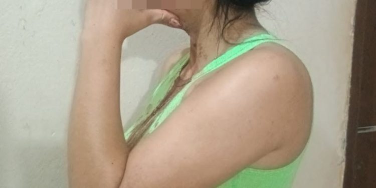 Mujer denuncia agresión en Remansito y el supuesto autor recupera su libertad