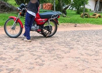 Caacupé: adolescente perdió un brazo tras enredarse su ropa en la rueda de una moto